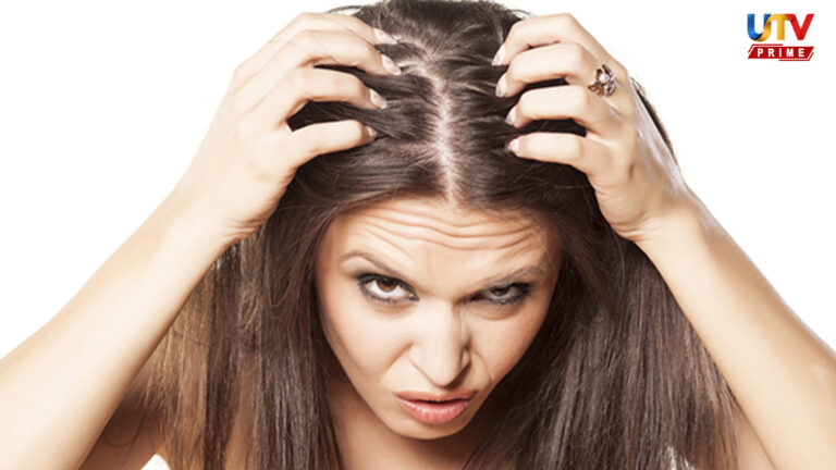 அரிப்பு மற்றும் தலைப்பேன் தொல்லையா?.. இந்த பொருட்களை வைத்து சட்டென விரட்டுங்கள்..! Lice infestation UTV